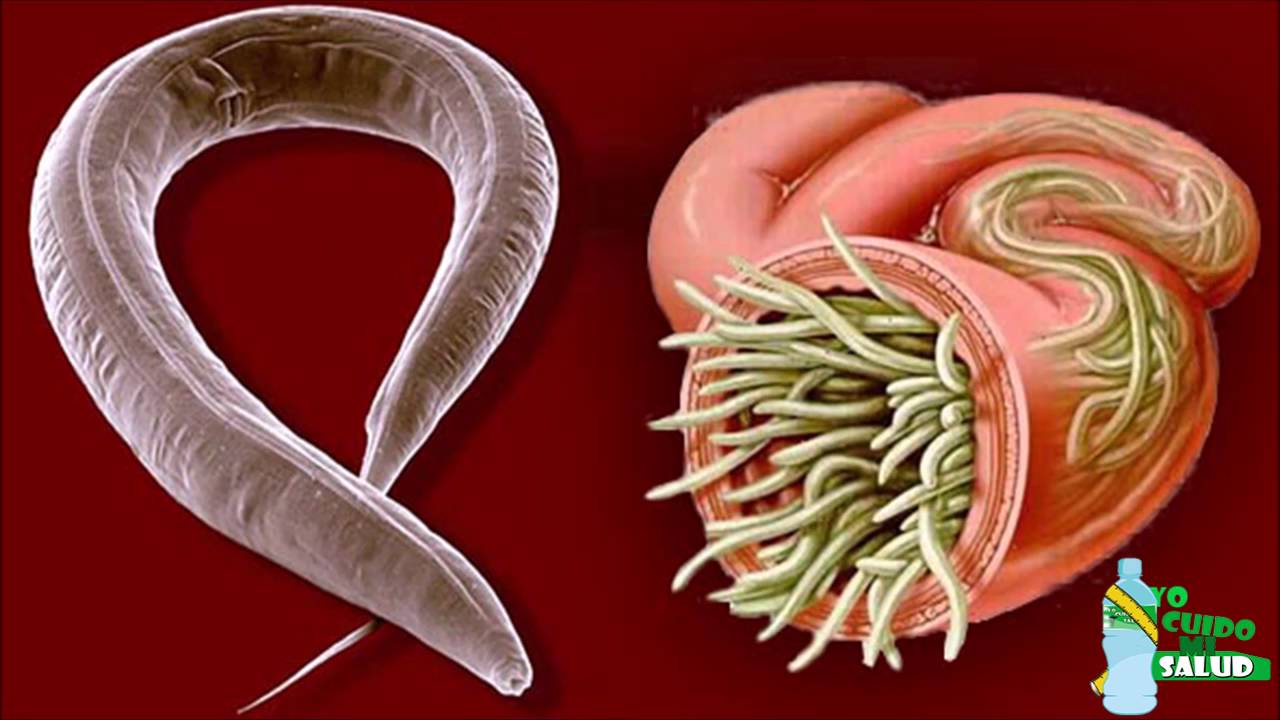 Maneras Naturales De Eliminar Los Parásitos o Lombrices Intestinales