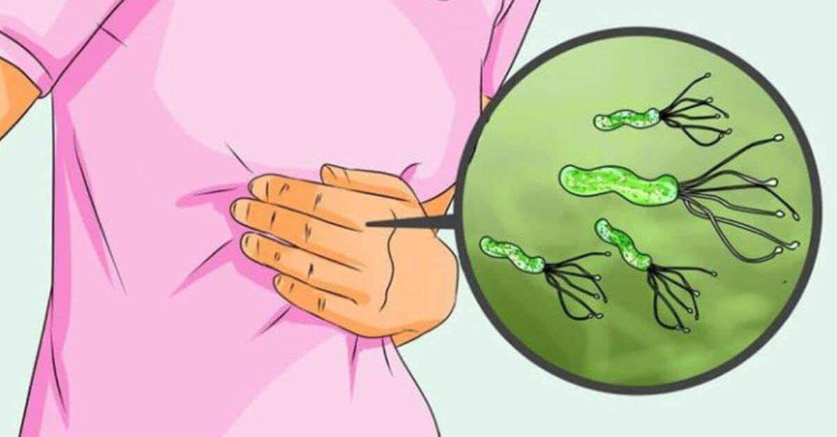Combata la bacteria Helicobacter Pylori con la alimentación eConsejos