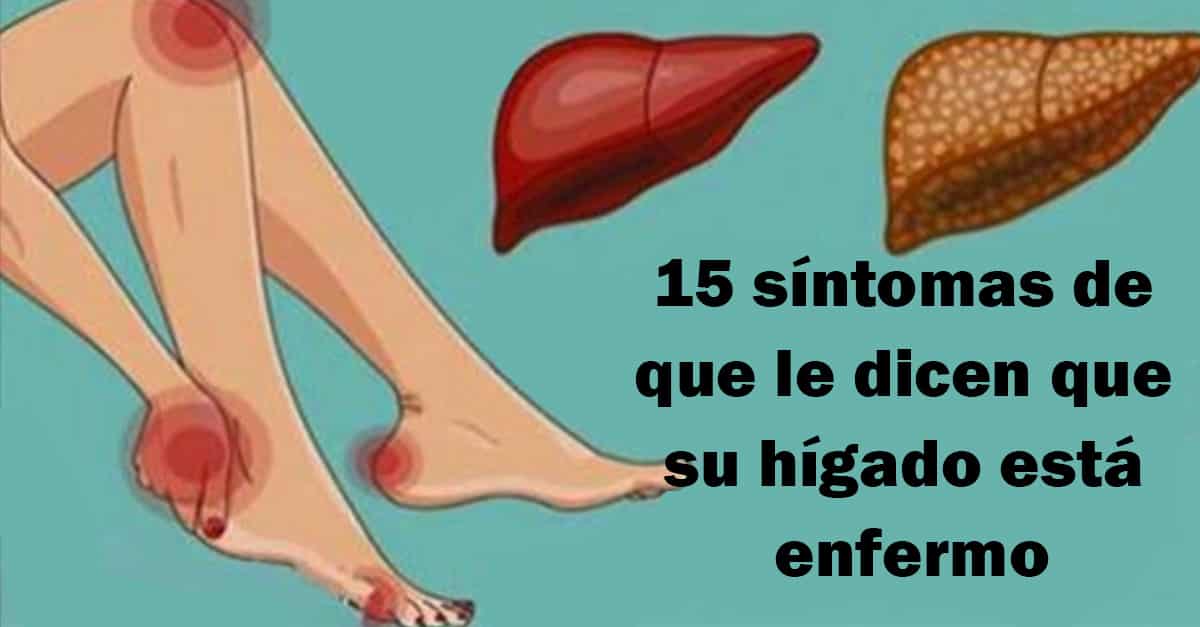 Aprenda a identificar y prevenir problemas en su h gado