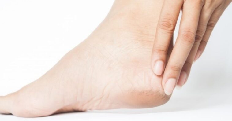 Crema hidratante natural para los pies