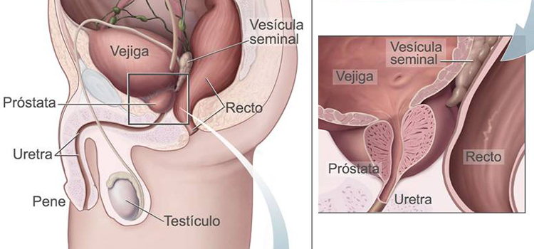 Eyaculacion frecuente reduce el riesgo de cancer de prostata prostata