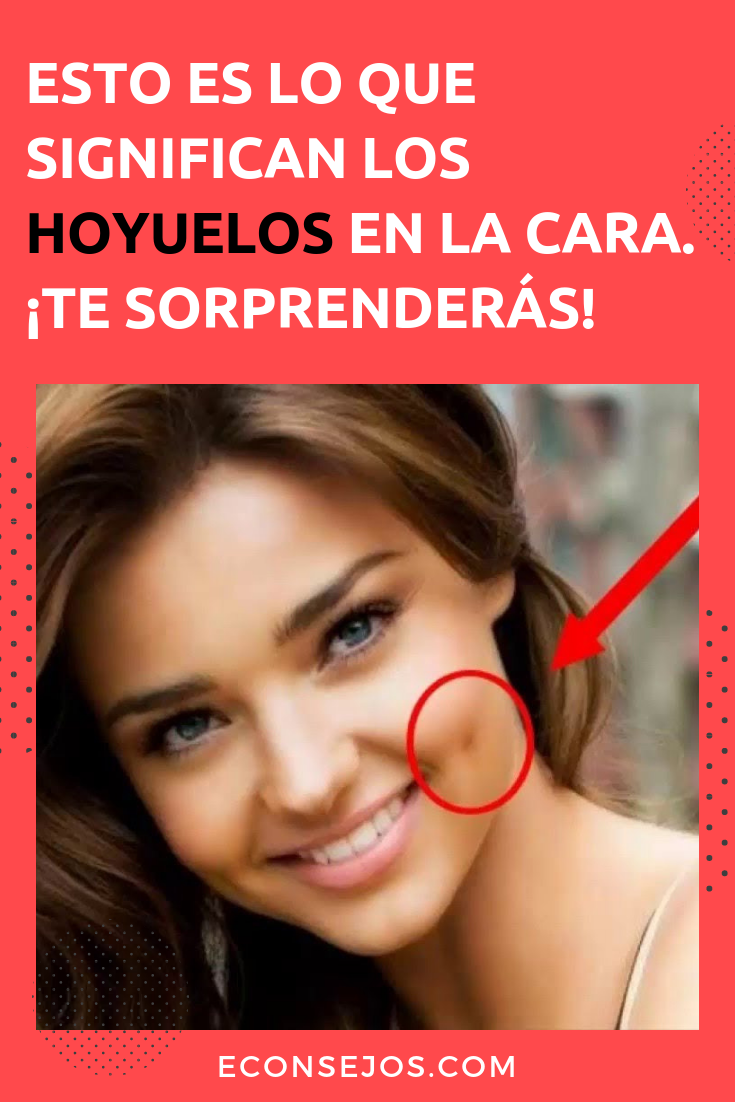 Hoyuelos en las mejillas
