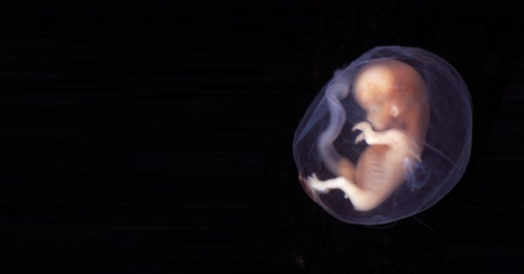 Mama comparte fotos de su feto abortado de 14 semanas