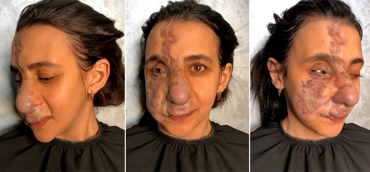 Maquilladora transforma el rostro de una mujer desfigurada desfigurada