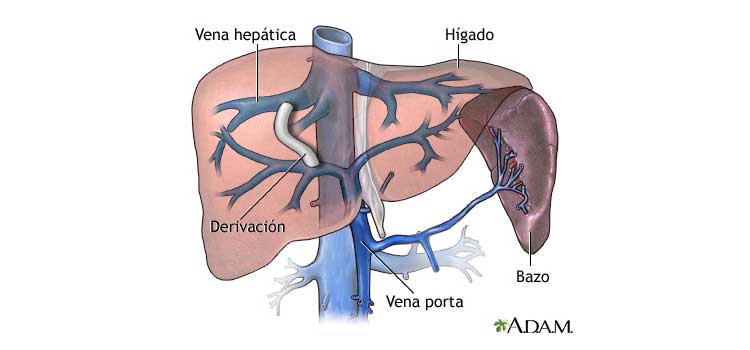 Niño de 9 años sufre agonía constante chiari