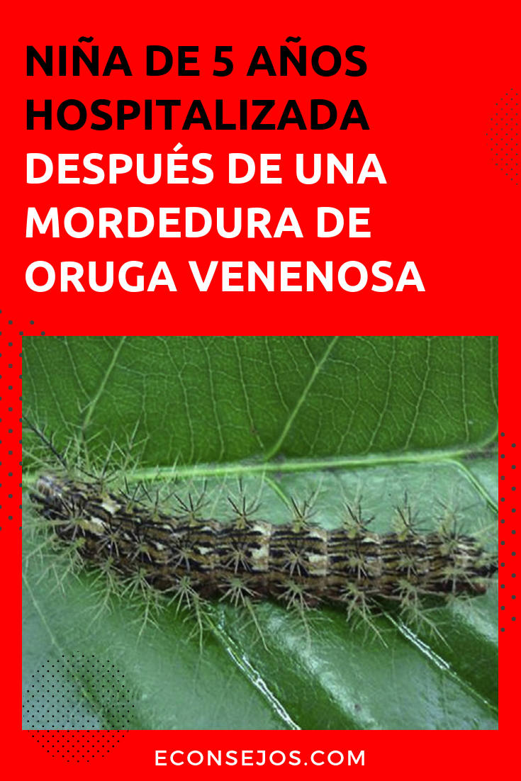 Orugas Venenosas