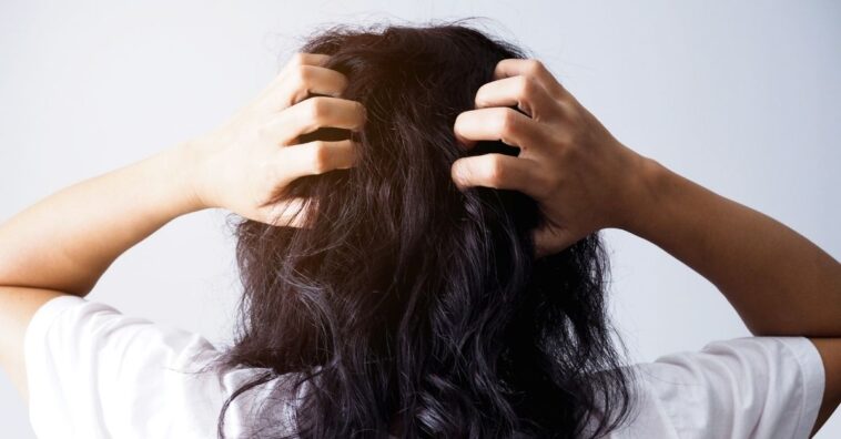 pasar muchos días sin lavarse el cabello