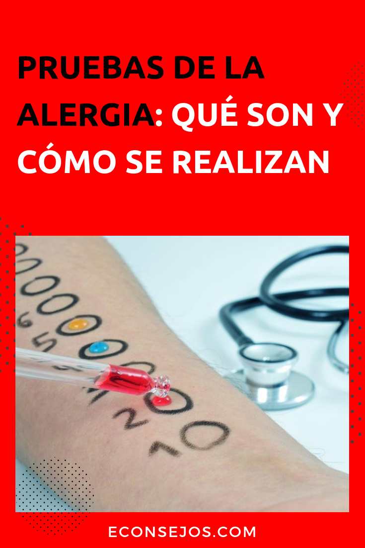 Pruebas de la alergia