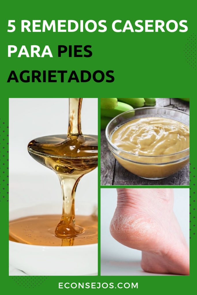 Remedios caseros para pies agrietados