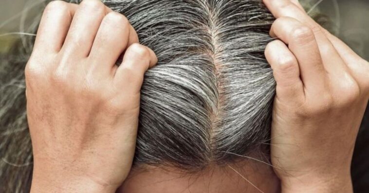 acabar con las canas y prevenir la caída del cabello con bicarbonato de sodio