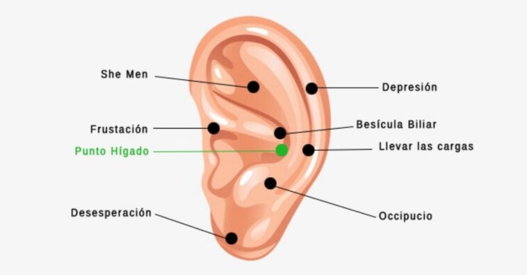 auriculoterapia