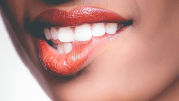 blanqueadores dentales pueden danar los dientes