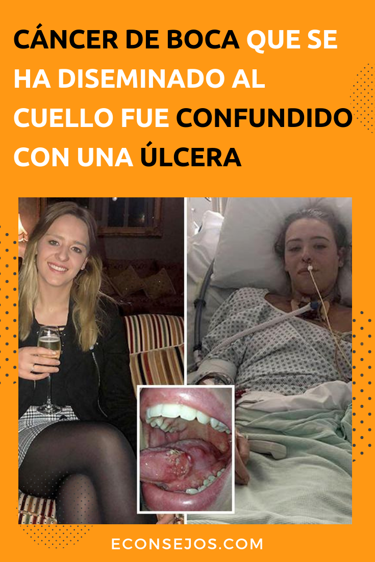 Cáncer de boca