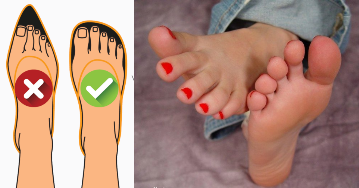 5 Consejos de zapatos para mujeres con los pies anchos