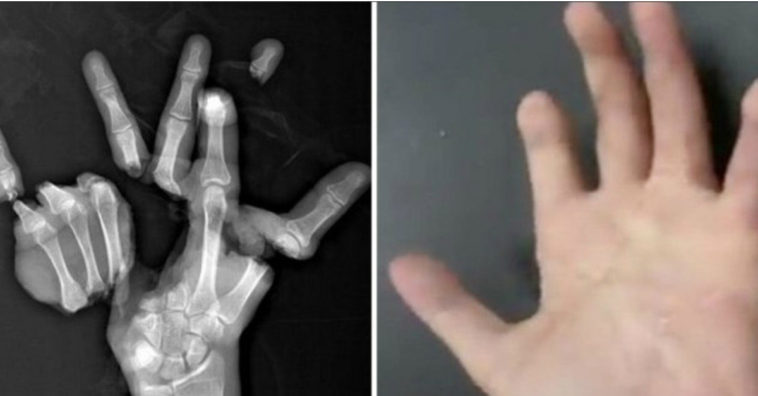 construye una mano triturada
