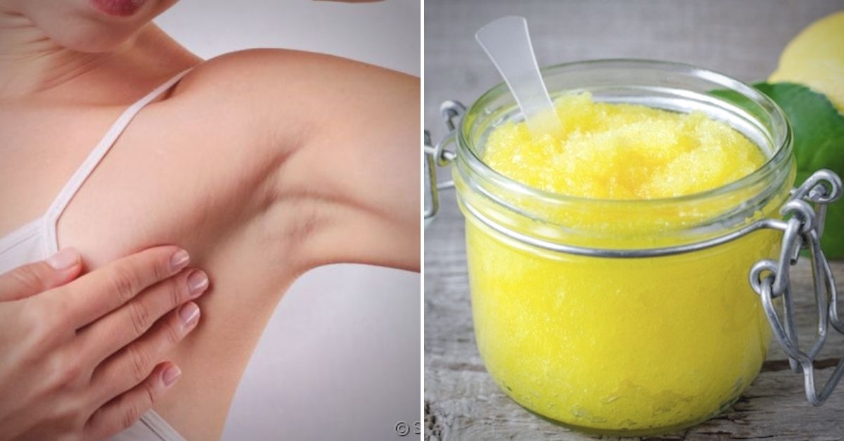 Que Láser Elimina El Vello Blanco Elimina el vello de las axilas con recetas caseras