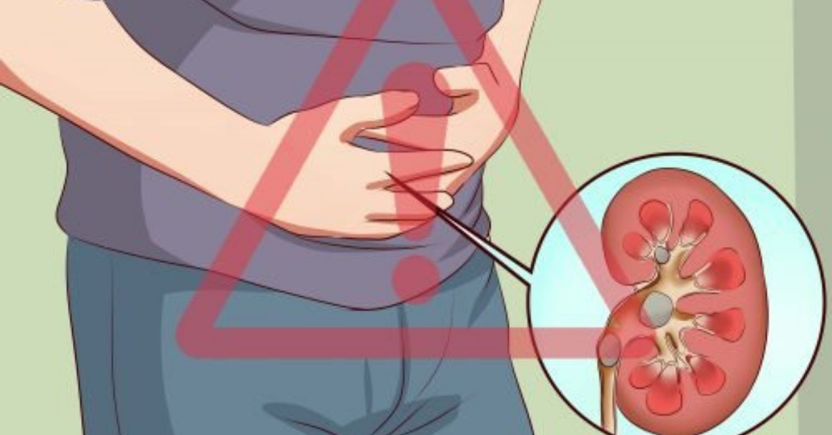 Dolor en los riñones: cómo saber dónde duele y qué hacer para tratarlo