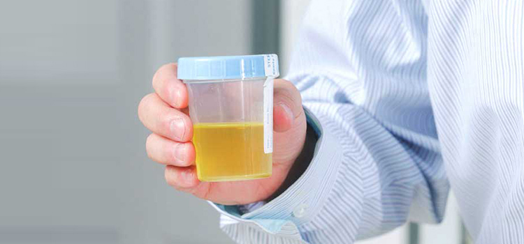 jugo de cilantro urinario