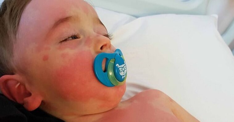 niño de 2 años de edad es hospitalizado con síndrome inflamatorio que puede estar relacionado con la covid-19