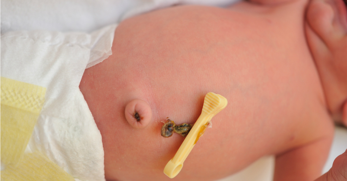 Que Se Debe Hacer Cuando El Ombligo De Un Bebe Esta Hacia Afuera E Consejos