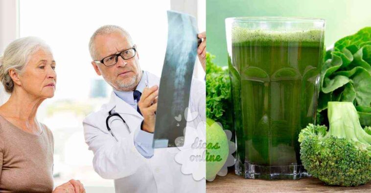 Sufres de osteoporosis