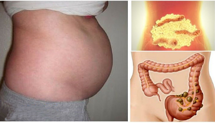 gases intestinales como eliminar