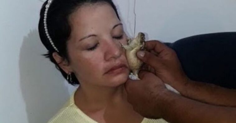 sapo cura el dolor de muela
