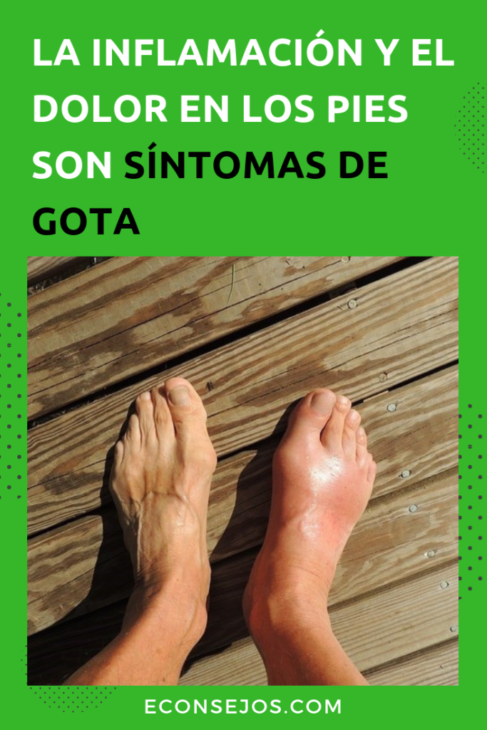 Enfermedad de la gota